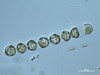Photo of Stephanopyxis nipponica